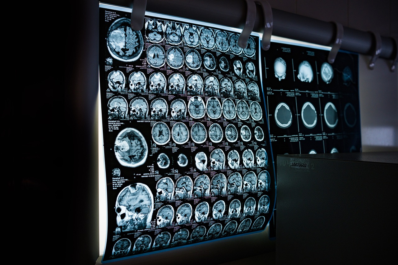 From air oscillations to music and speech:: Functional magnetic resonance imaging evidence for fine-