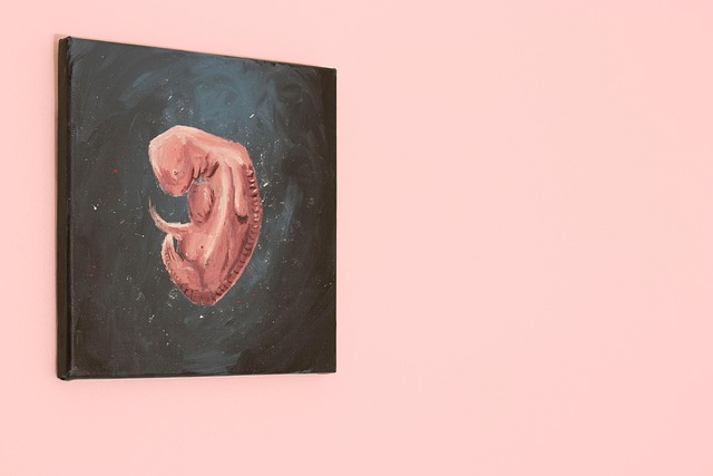 Abortion for fetal CNS malformations: religious aspects